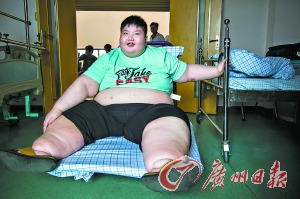 14歲男孩體重300斤腰圍超身高求醫十年無果(圖)