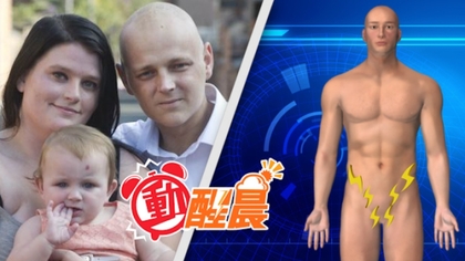 男腰痛本以為“害喜” 竟是患上睪丸癌 男腰痛本以為“害喜” 竟是患上睪丸癌
