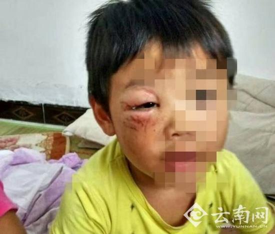 老婆離家出走 男子虐待4歲兒子在朋友圈曬圖 老婆離家出走 男子虐待4歲兒子在朋友圈曬圖