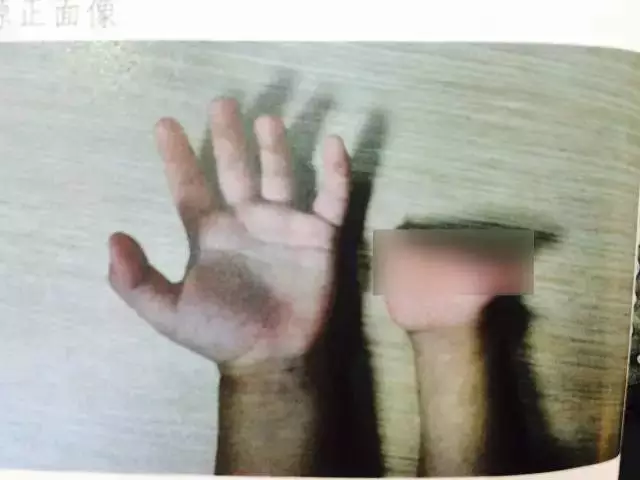 孕婦多次產檢仍生下唇腭裂女兒 家屬要求醫院擔責