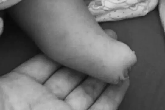 孕婦多次產檢仍生下唇腭裂女兒 家屬要求醫院擔責